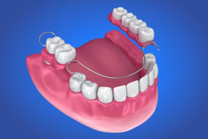 denture tooth immediate dentures