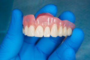 wobbly denture cream adhesives