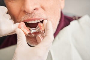 can you sleep with dentures wear